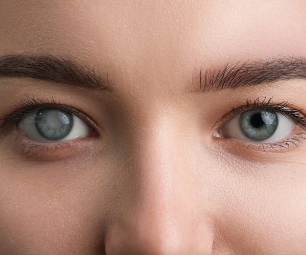 Glaucoma Surgery