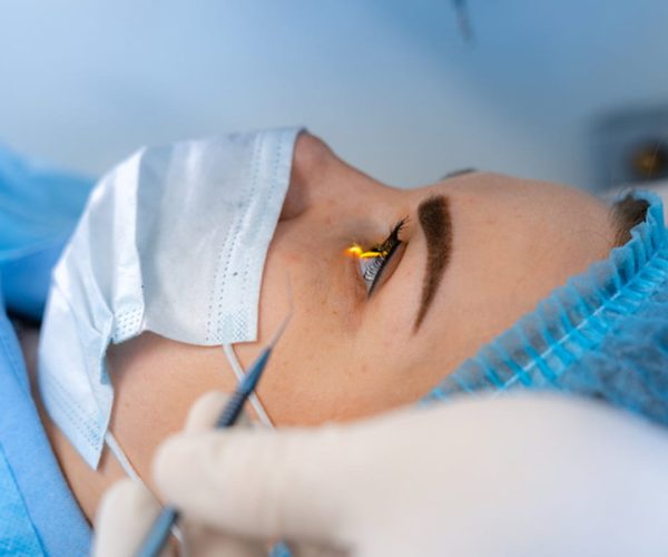 Laser Eye Surgery
