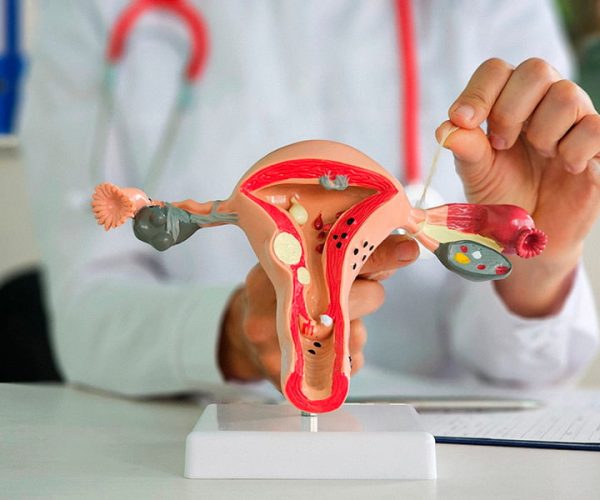 Tubal-Ligation