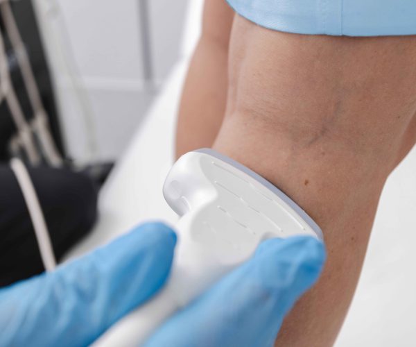 Venous-Vascular-Ultrasound-(Lower-Extremity) Duplex ultrasound to evaluate blood flow in the legs and feet.