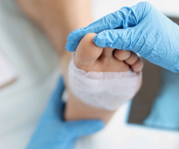 Wound-Care-(Foot-&-Ankle) Comprehensive treatment to heal acute and chronic foot wounds