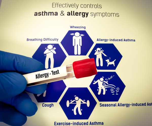 Test,Tube,With,Blood,Sample,For,Food,Allergy,Test,With