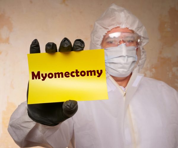 Healthcare,Concept,About,Myomectomy,With,Phrase,On,The,Sheet.