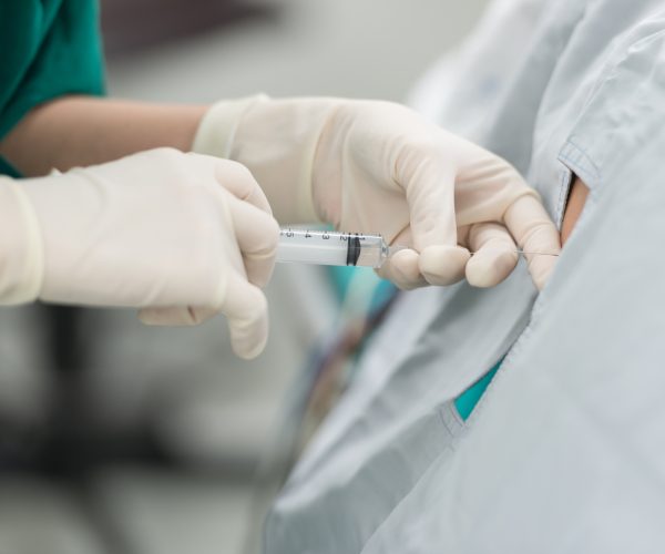 Spinal,Nerve,Block