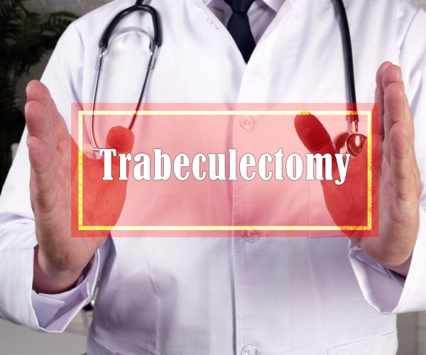Trabeculectomy,Filtration,Surgery,Sign,On,The,Piece,Of,Paper.