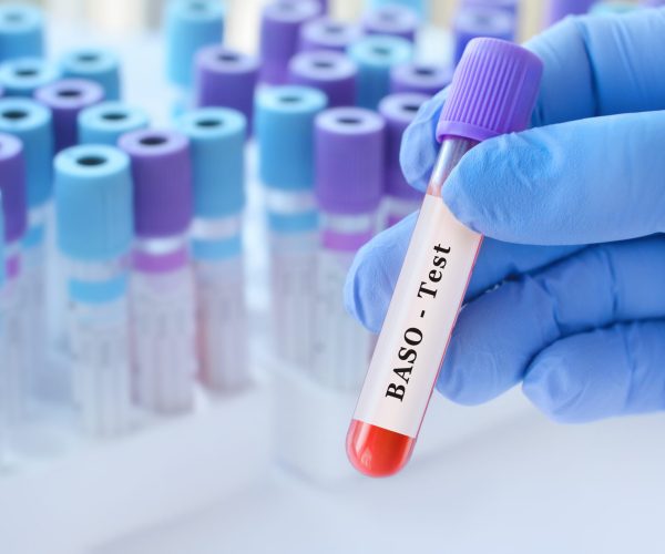 Doctor,Holding,Blood,Sample,Tube,With,Baso,Test,In,Medical