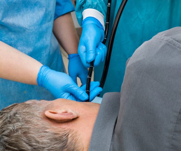 Esophagogastro­duodenoscopy (EGD)